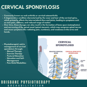 Cervical-spondylosis