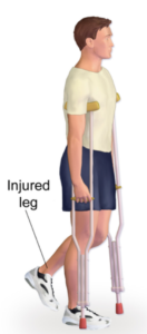 crutches